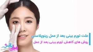 rhinitis after rhinoplasty.jpg