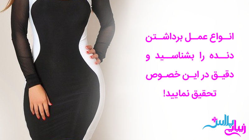 انواع روش برداشتن دنده برای اندام ساعت شنی
