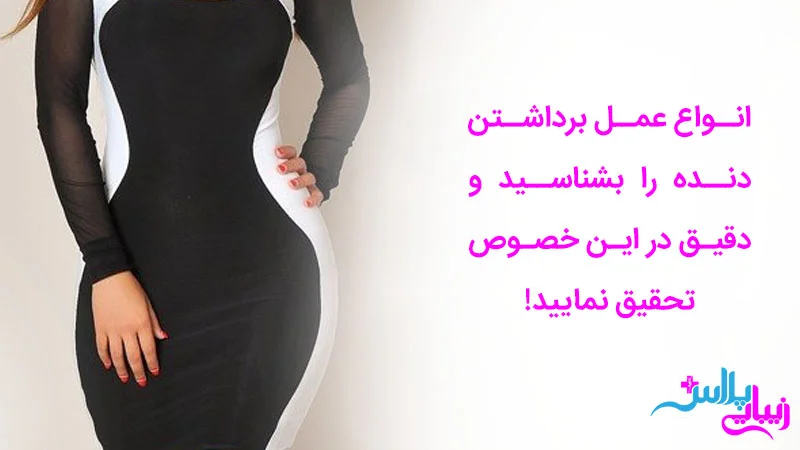 انواع روش برداشتن دنده برای اندام ساعت شنی