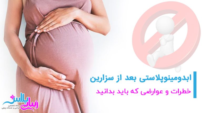 abdominoplasty after cesarean 1.jpg
